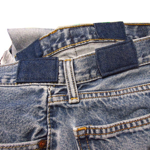 Repair Of Lost Suspender Points